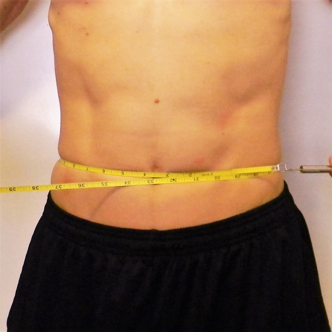 Circumference measure of the abdomen.